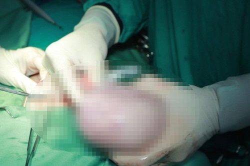 Băn khoăn về phương pháp định giá trong khám, chữa bệnh theo yêu cầu