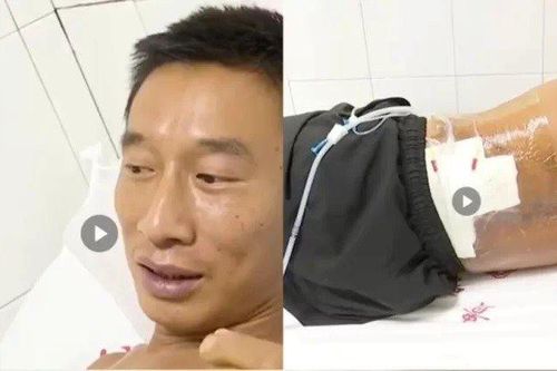 Bị 'trời đánh' 2 lần trong 5 phút không chết