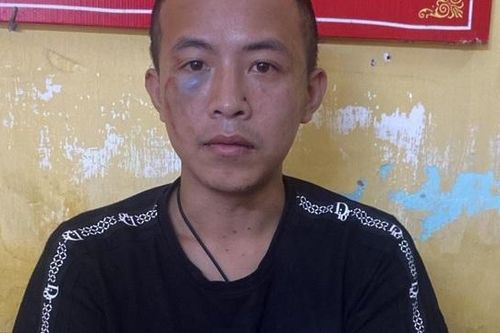 Xô xát ở chợ, nam thanh niên dùng dao chém trọng thương 3 người