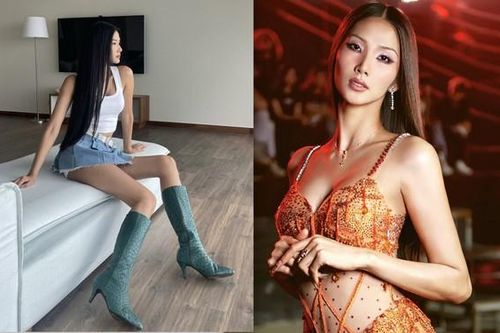 Á hậu - siêu mẫu có đôi chân lệch nhau 2cm là ai?