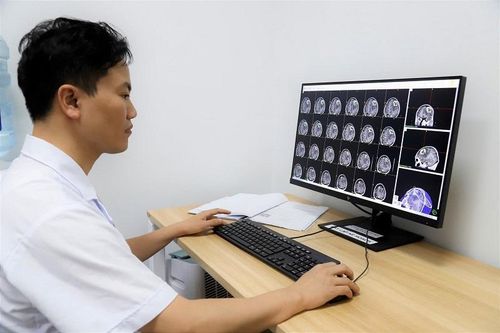 Xuất viện sau một ngày xạ phẫu gamma điều trị u não