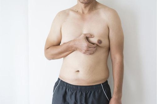 Nỗi khổ của những người đàn ông mang bộ ngực phụ nữ