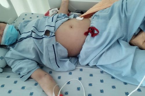 Mở rộng lòng từ: Giúp em Tâm Như chi phí điều trị bệnh lupus