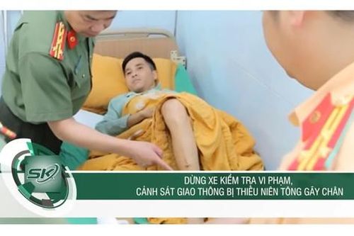 Không đội mũ bảo hiểm, thanh niên đâm gãy chân, vỡ xương gò má đại úy CSGT