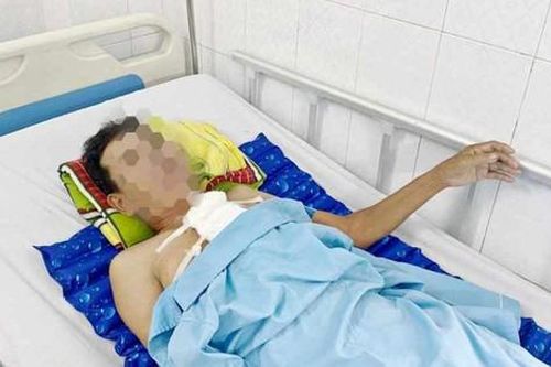 Người đàn ông chấn thương ngực nguy kịch do trâu húc