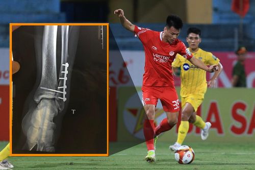 Nghị lực đáng nể của tân binh tuyển Việt Nam từng bị đóng 6 chiếc đinh ở cổ chân