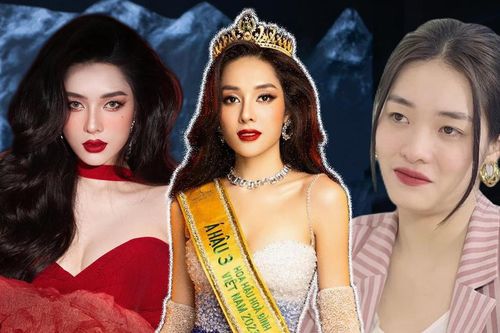 Á hậu 'đập mặt xây lại' công khai tiền sửa mũi, nghe xong ai cũng choáng!