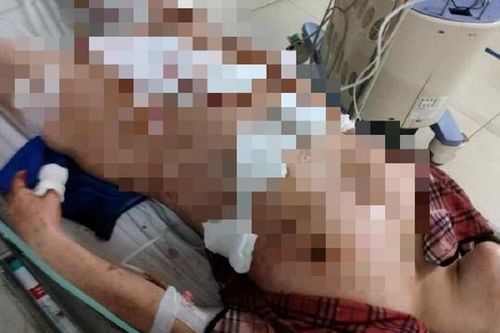 Người chồng ghen tuông hành hạ vợ như thời trung cổ