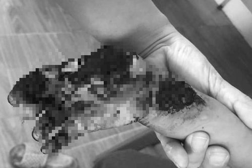 Cảnh báo trẻ bị điện giật do sạc điện thoại