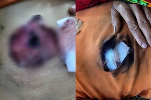 Không chịu gói bánh cúng rằm, người vợ bị chồng bắn trọng thương