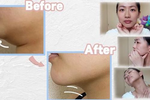 Nọng cằm biến mất sau 7 ngày thực hiện động tác này mỗi tối