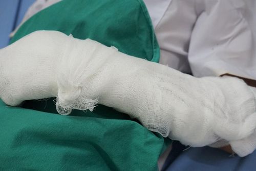Hút thuốc lá gây nổ bóng bay tại lễ khai giảng: Yêu cầu kiểm điểm thầy giáo