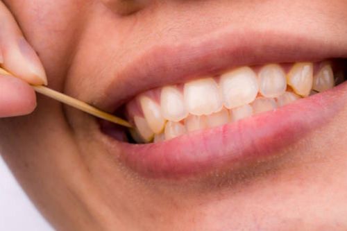 Vì sao không nên dùng tăm xỉa răng?