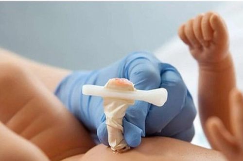 Bệnh viện Sản Nhi Nghệ An cứu sống trẻ sơ sinh bị uốn ván rốn nguy hiểm