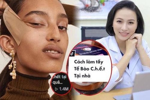 Hội chị em rủ nhau học theo TikTok dùng 'băng dính, nước muối, baking soda' làm đẹp da và lời khuyên của bác sĩ