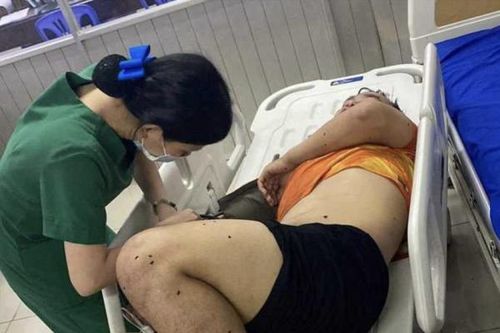 Triệu tập gần 20 người liên quan đến vụ mâu thuẫn đánh nhau trên sân bóng phủi