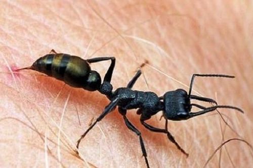 Người đàn ông bị sốc phản vệ do kiến cắn vào trán