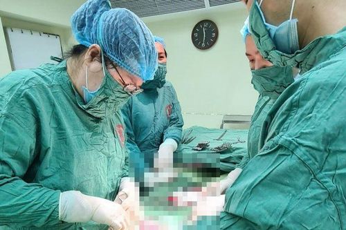 Tự mua thuốc uống trị khối u, người phụ nữ nguy kịch