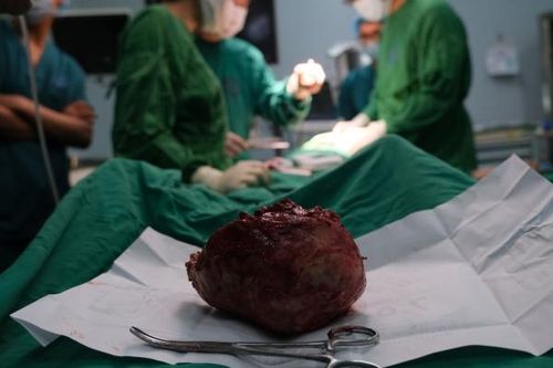 Phẫu thuật cấp cứu cho cụ bà mang khối bướu cổ 'khổng lồ' suốt 40 năm
