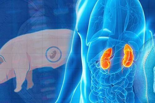 Những bước tiến trong nuôi cấy thận trên phôi lợn để ghép cho người
