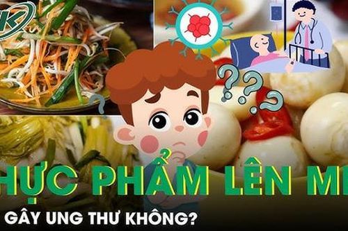 Thực phẩm lên men liệu có gây ung thư?