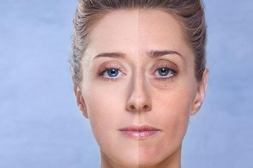 Cách khắc phục làn da xỉn màu, thiếu sức sống