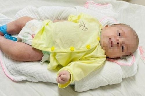 Sinh con tại nhà, bé sơ sinh bị uốn ván rốn nặng