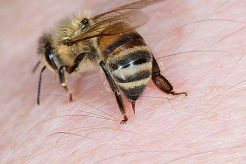 Thêm 4 người phải cấp cứu vì ong đốt