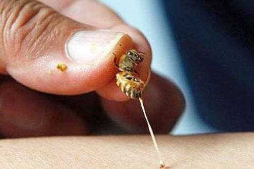 Cao Bằng: Nhiều trường hợp bị ong đốt phải nhập viện cấp cứu