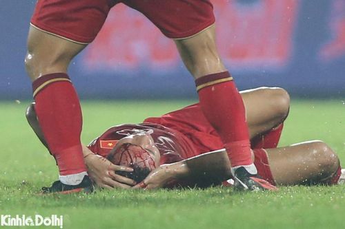 Việt Hưng phải khâu 20 mũi ở đầu, Trung Hiếu gãy xương mác