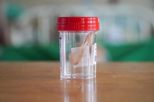 Muôn kiểu hóc dị vật