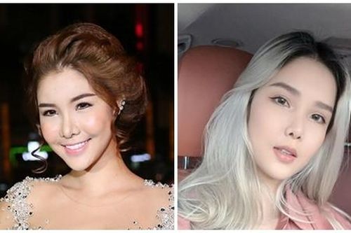 Thừa nhận khủng hoảng vì 'dao kéo', Kỳ Hân thay đổi thế nào?