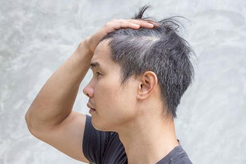 Vì sao tóc bạc sớm, làm gì để hạn chế?