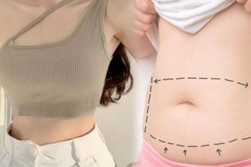 Phẫu thuật tạo hình thành bụng để có eo săn chắc, rãnh bụng sâu: 5 yếu tố tác động đến kết quả cuối cùng