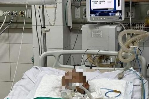 Cứng hàm, khó nuốt sau khi bị vật cứng rơi vào chân