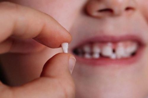Trẻ bắt đầu thay răng ở độ tuổi nào, làm gì để tránh mọc lệch?
