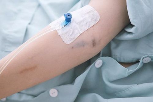 Nguy hiểm khi truyền dịch tại nhà