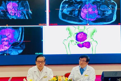 Vinmec phẫu thuật thành công khối u hiếm gặp