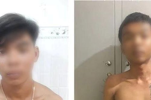 Khởi tố, bắt tạm giam nhóm đối tượng vô cớ chém người sau cuộc nhậu