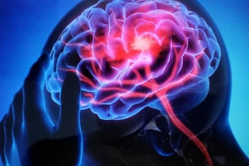 Đột ngột dừng thuốc, người bệnh động kinh gặp nguy hiểm gì?