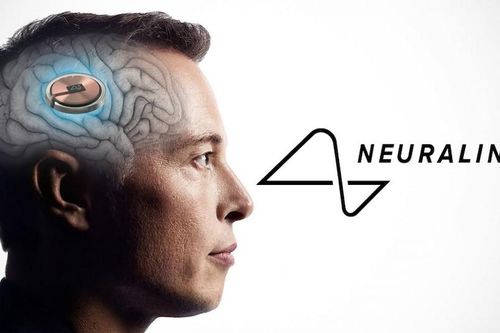 Công ty của tỷ phú Elon Musk bắt đầu thử nghiệm cấy chip não vào người