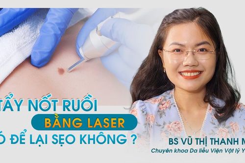 Khỏe đẹp 24h: Tẩy nốt ruồi bằng laser an toàn, không để lại sẹo