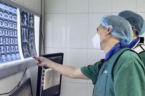 Bé 10 tuổi vỡ mạch máu não, cha mẹ cần biết rõ căn bệnh nguy hiểm này