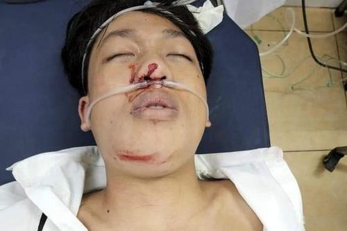 Chồng biệt tích, con trai gặp tai nạn nguy kịch trên đường đi học về, người mẹ khẩn cầu giúp đỡ