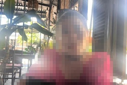 Mũi bị biến dạng sau phẫu thuật, khách hàng 'tố' thẩm mỹ viện