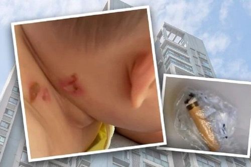 Xét nghiệm ADN dân cư cả tòa nhà 26 tầng tìm kẻ ném thuốc lá làm em bé bệnh nặng