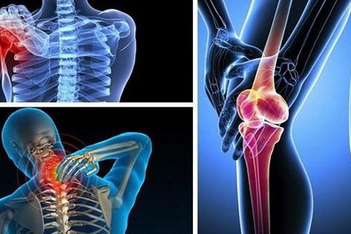 Từ vụ thanh niên 19 tuổi bị ung thư xương, chuyên gia chỉ rõ dấu hiệu cảnh báo bệnh