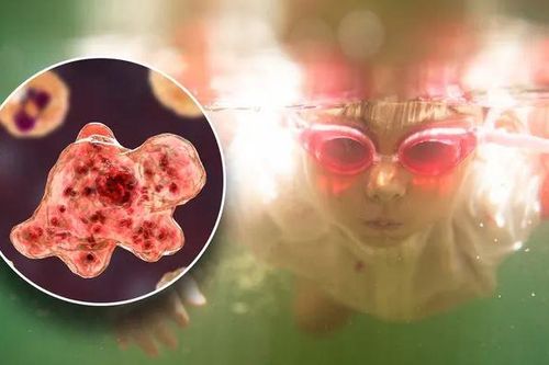 Cảnh báo nguy cơ nhiễm khuẩn 'ăn não người' khi bơi sông, hồ