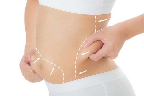 Hút mỡ bụng có để lại sẹo?