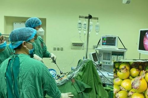 Bị tắc ruột do ăn 5 quả hồng lúc đói